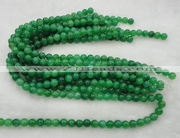 CAG420 15.5 inches 10mm round green agate beads Wholesale