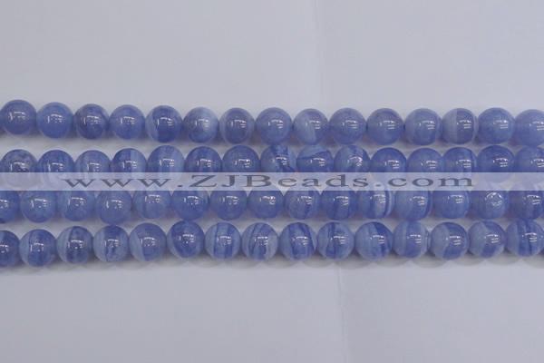 CAG5973 15.5 inches 10mm round blue lace agate beads wholesale