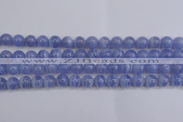 CAG5973 15.5 inches 10mm round blue lace agate beads wholesale