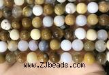 CBC804 15.5 inches 12mm round natural polka dot chalcedony beads