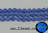 CLU173 15.5 inches 14mm flat round blue luminous stone beads
